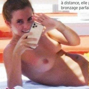 Delphine EMMA WATSON TOPLESS NUDE SUNBATHING PHOTOS PUBLISHED IN FRANCE - France on ladyda.com
